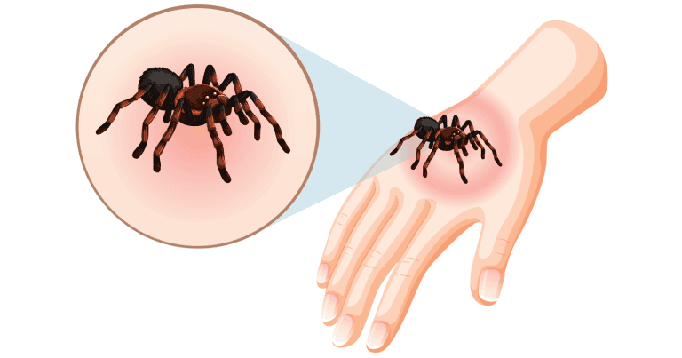 Araignée de tique infectée transmettant une maladie via piqûre sur la peau humaine, service de désinsectisation professionnel, élimination des parasites, protection contre les tiques.